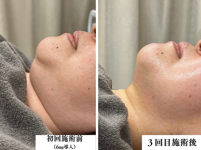 LICCO'S（リコス）岡崎店