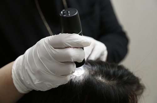 薄毛・抜け毛・ボリューム不足など、年齢やホルモンバランスによる髪のお悩みに。頭皮環境から整える！