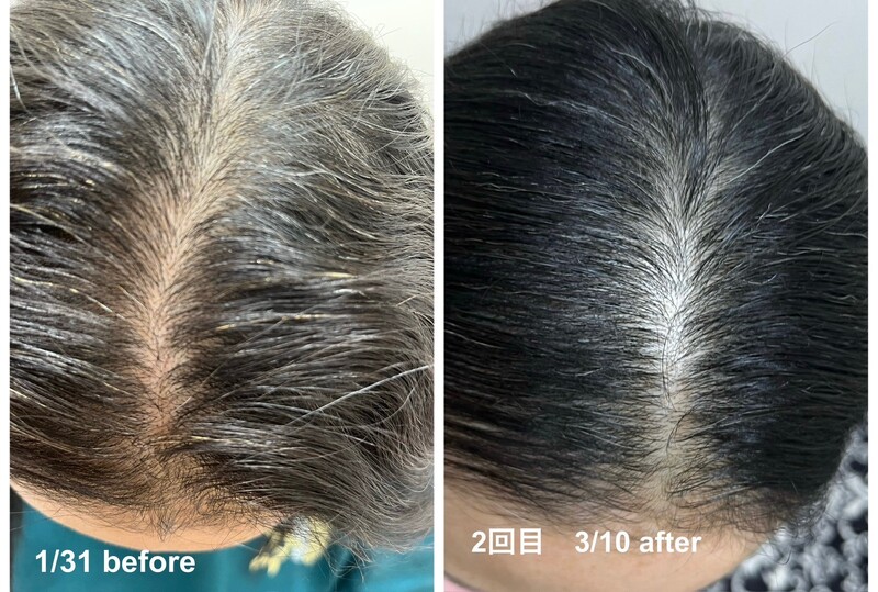 髪質改善を整えることで、白髪軽減にもつながります。