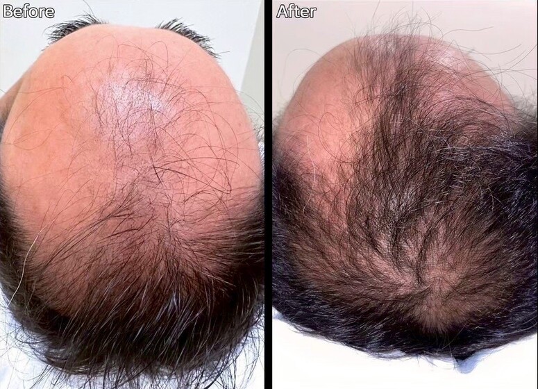 自己発育を促す確かな施術！