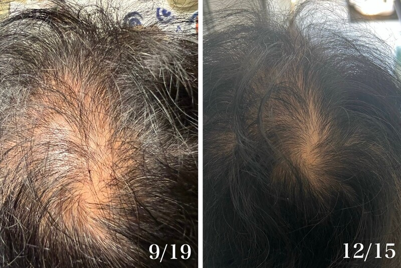 3ヵ月でここまでの変化が！