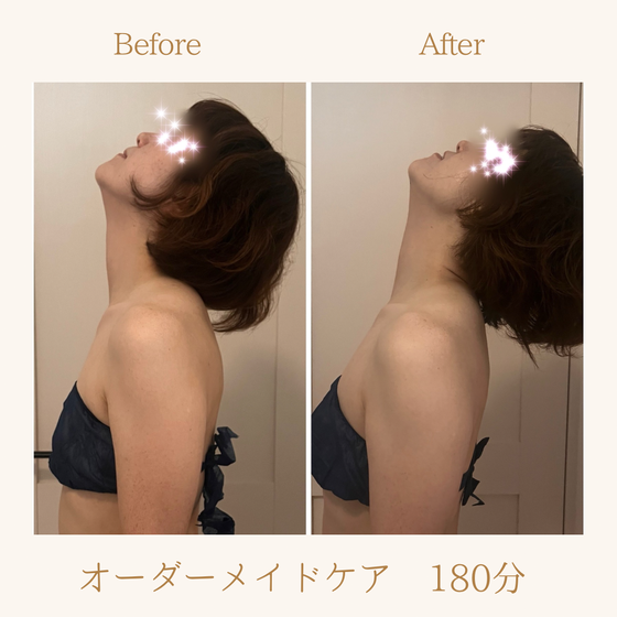 二重顎、実は「脂肪だけ」が原因ではないかもしれません♡  巻き肩や猫背で頭が前に出る姿勢になると、首まわりが縮こまり、フェイスラインがもたついて見えることも。  全身の筋肉を丁寧に調整し、巻き肩や姿勢を整えることで、首の可動域もスムーズに。  姿勢が変わると、フェイスラインもスッキリとした印象に♡  「最近、二重顎が気になる…」 そんな方は、「美姿勢デザインケア　90分」もおすすめです。