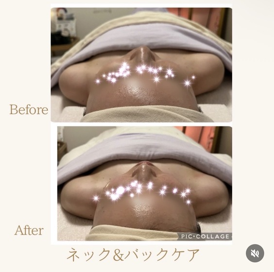 巻き肩ケアもお任せください！デスクワークのお仕事は、肩を内側に捻り固定する姿勢を長時間とりますよね。それが巻き肩を定着させてしまう為、捩れて硬くなった筋肉を丁寧に緩めて元の位置へ戻すと肩こり首こりが楽になりますよ