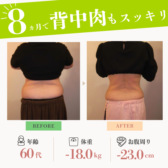 ＜60代女性＞お洋服を着ても隠せない”背中の丸み”が気になる方！