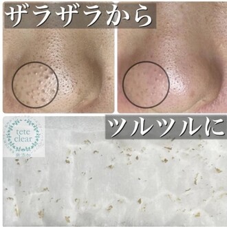 シミ・毛穴悩みに特化した結果重視フェイシャル