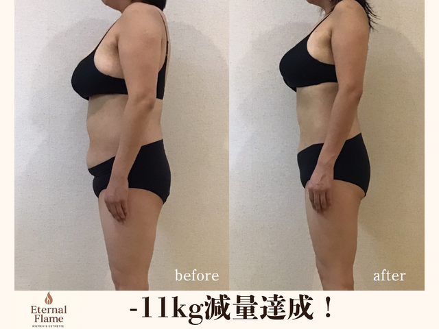 エステティックサロン Eternal flame