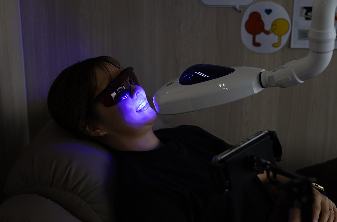 白い歯をゲット！地域最長照射のセルフホワイトニング体験記【FRESCOレディース刈谷店】