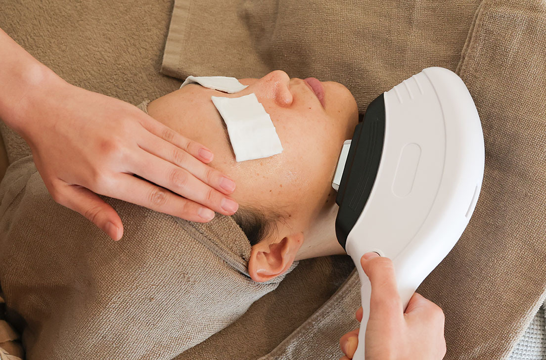 【体験レポ】垢となって剥がれる！サロンドエラの白玉シミケア3回コース